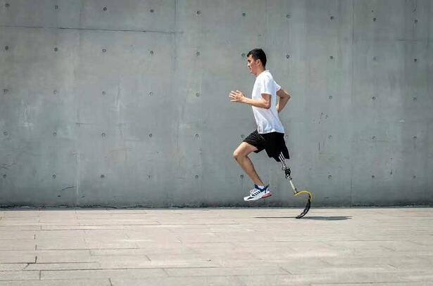 假肢廠家淺談下肢假肢如何做好護(hù)理工作(圖1) 假肢價格