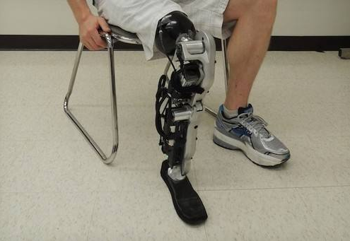 安裝假肢前先綁繃帶有哪些好處?(圖2) 假肢